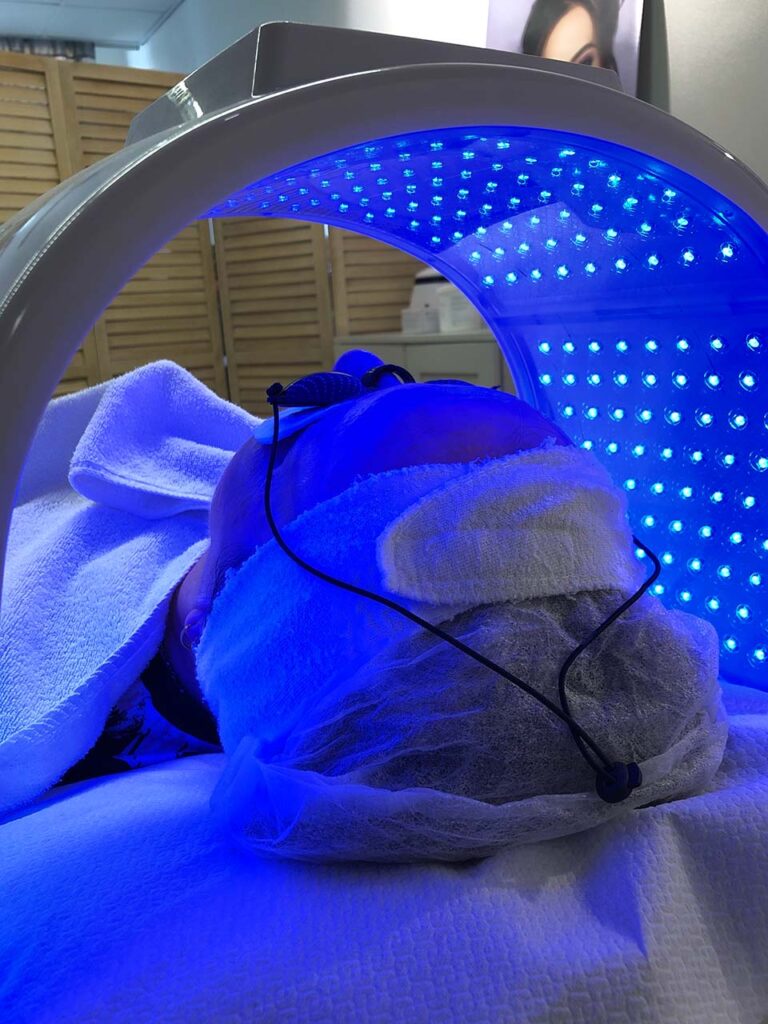 Led valoterapia